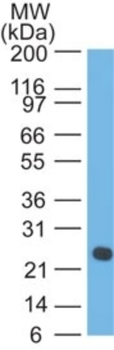 IGLV1-51 Antibody (CF488)
