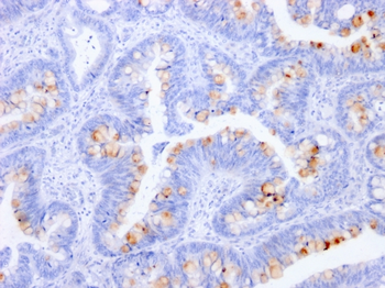 CEACAM5 Antibody