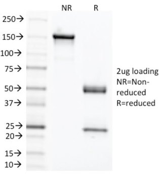 CEACAM5 Antibody