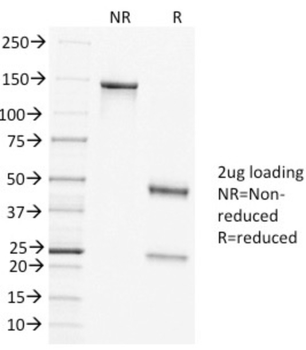 CLTCL1 Antibody