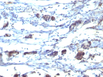 CCR5 Antibody