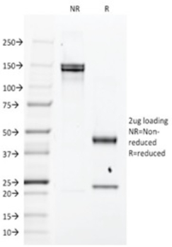 EGFR Antibody