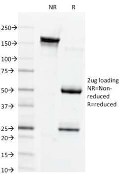GJB1 Antibody