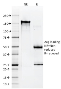 HLA-B Antibody