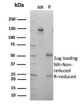 HLA-DPB1 Antibody