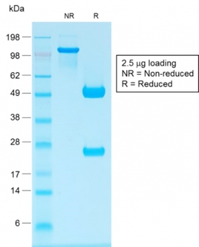 IGHG1 Antibody