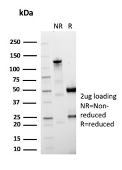 IGHG1 Antibody