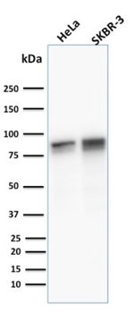 JUP Antibody