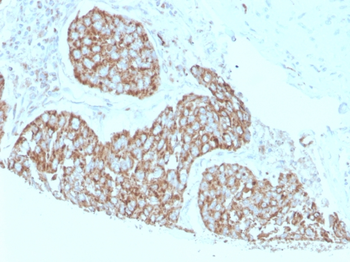 S100A9 Antibody
