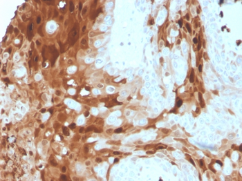 S100A9 Antibody