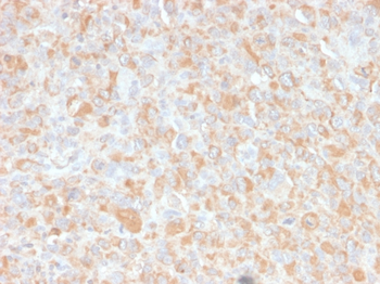 TNF Antibody