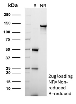 CD70 Antibody