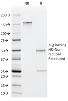 EBV Early Antigens (Epstein Barr Virus) Antibody