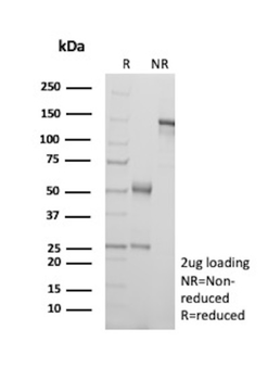 gag-pol Antibody