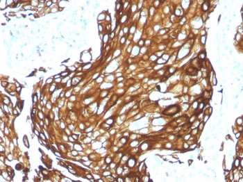 KRT77 Antibody