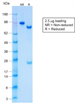 KRT77 Antibody
