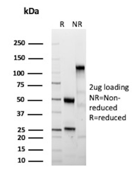 KRT77 Antibody