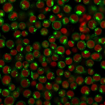 TFRC Antibody