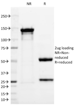 UCHL1 Antibody