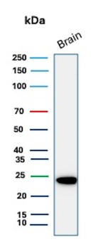 UCHL1 Antibody