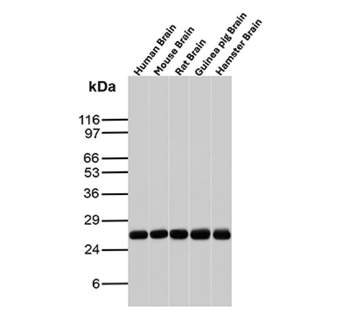 UCHL1 Antibody