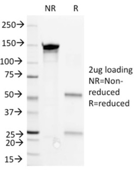 CD36 Antibody