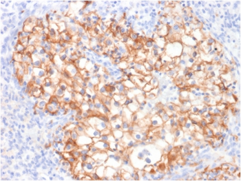 CDH16 Antibody