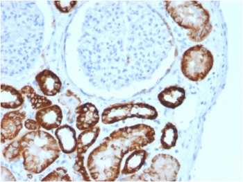 CDH16 Antibody