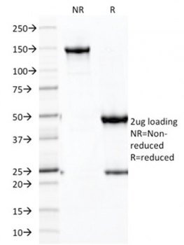 CDH16 Antibody