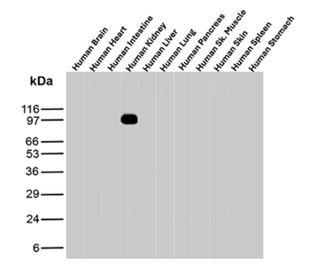 CDH16 Antibody