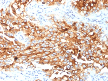 MSLN Antibody