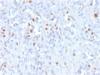 CDKN1A Antibody