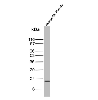 CDKN1A Antibody