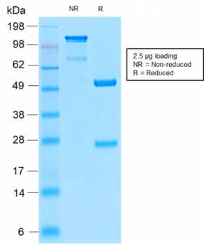 CD52 Antibody
