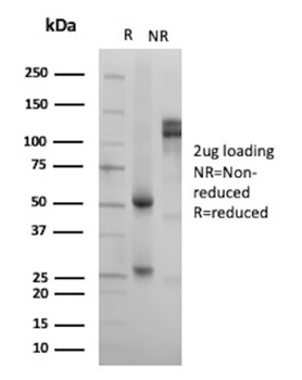 CD52 Antibody