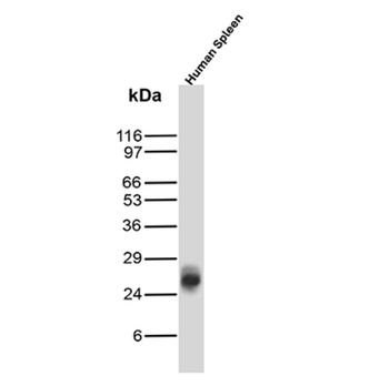 CD52 Antibody