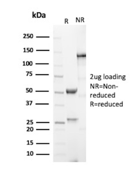 CDX2 Antibody