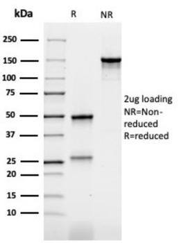 CEACAM5 Antibody