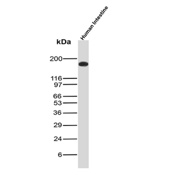 CEACAM5 Antibody