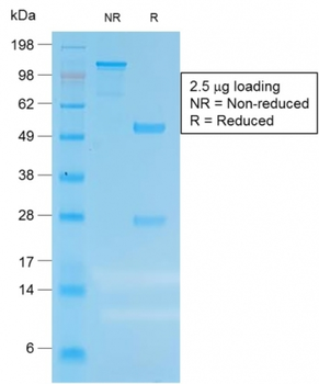 CEACAM5 Antibody