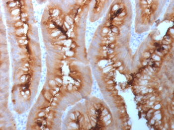 CEACAM5 Antibody