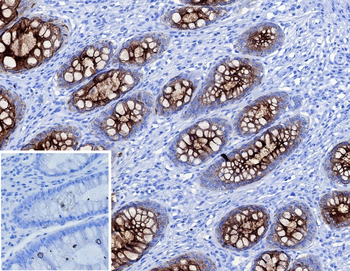 CEACAM5 Antibody