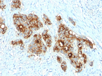 CEACAM5 Antibody