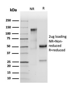 CEACAM5 Antibody