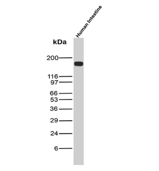 CEACAM5 Antibody