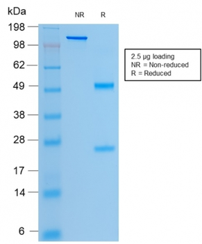 CFTR Antibody