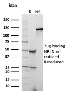 CFTR Antibody