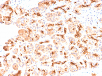 CFTR Antibody