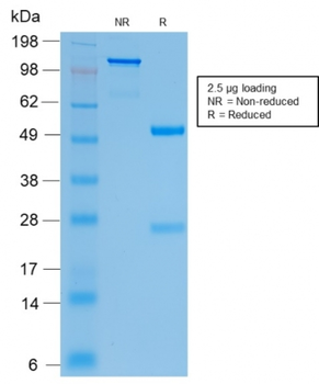 CFTR Antibody