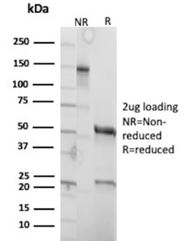 CFTR Antibody